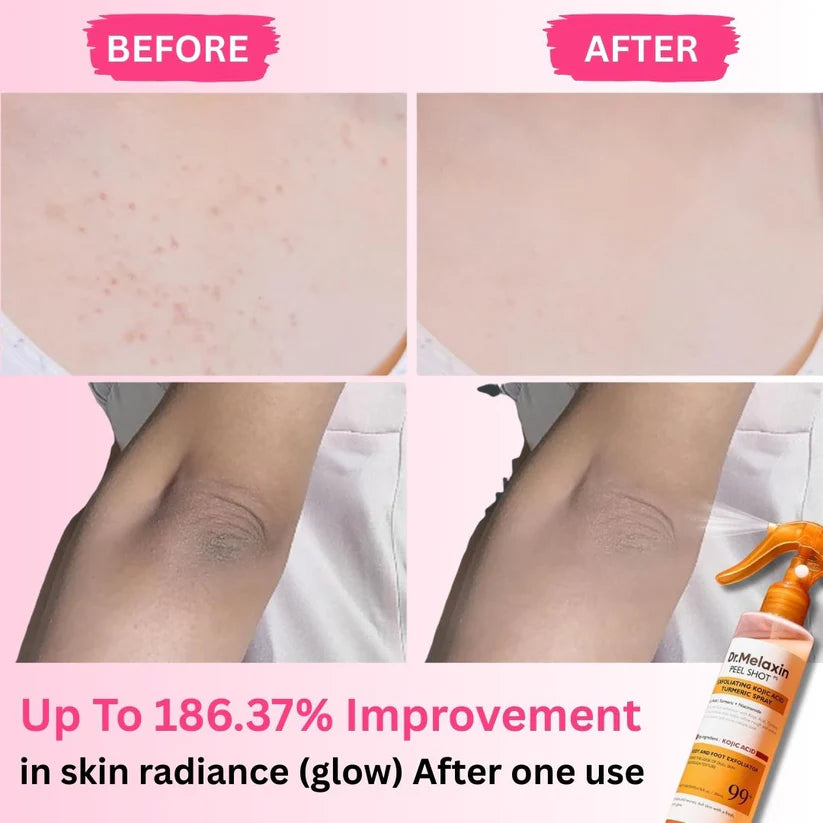 Dr. Melaxin™ Peel Shot: Spray, Scrub & Fade Dark Spots Fast