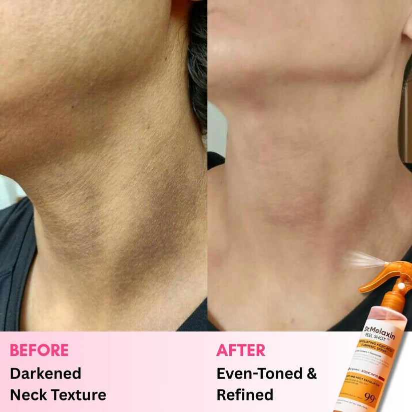 Dr. Melaxin™ Peel Shot: Spray, Scrub & Fade Dark Spots Fast