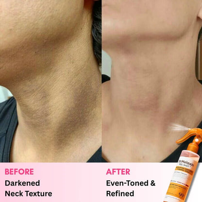 Dr. Melaxin™ Peel Shot: Spray, Scrub & Fade Dark Spots Fast
